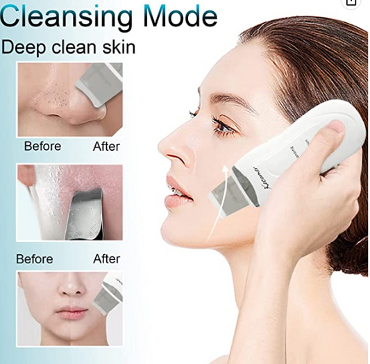 Limpiador Facial Ultrasonico